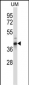 OAF Antibody (N-term)